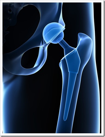 Back Pain Auburn ME Joint Replacement
