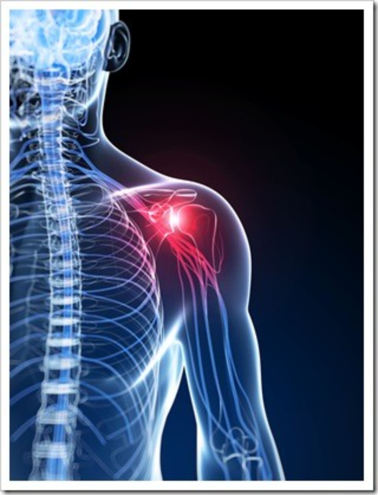 Frozen Shoulder Auburn ME Neck Pain