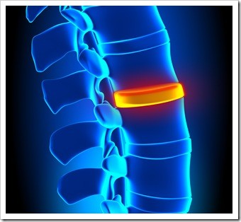 Herniated Disc and Back Pain Auburn ME