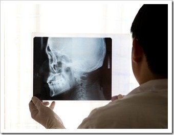 Auburn TMJ Jaw Pain Treatment